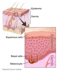Treat Skin Cancer and Other Growths